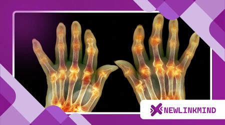 Yoga for Seniors with Arthritis: Safe and Soothing Poses